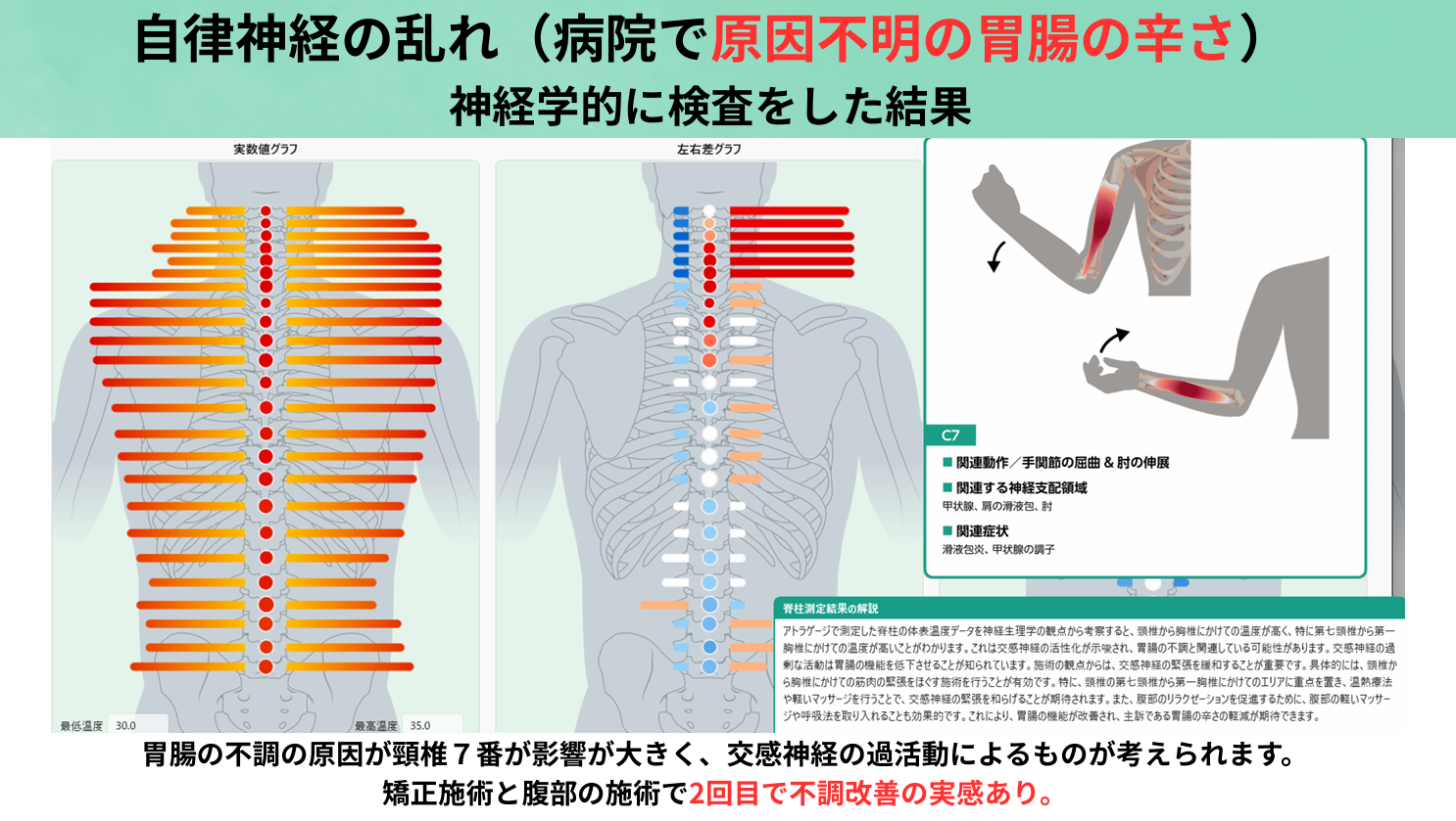 AI検査イメージ
