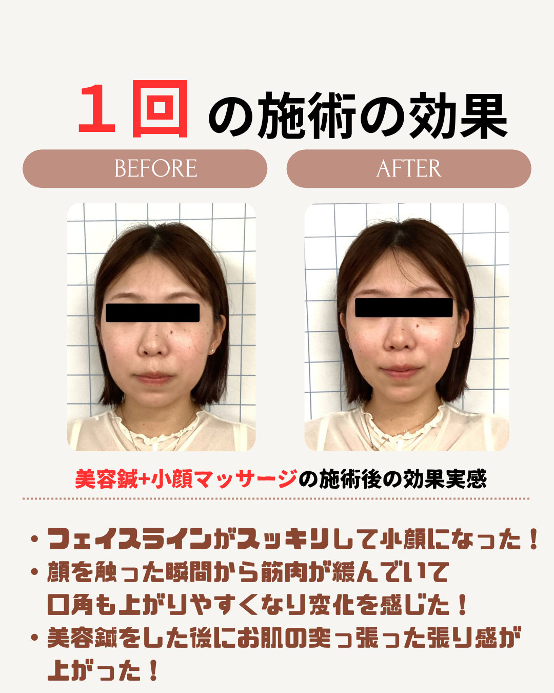 美容鍼効果事例