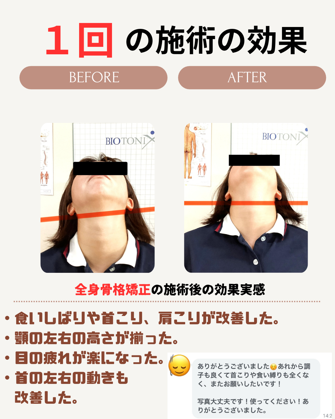 美容鍼効果事例