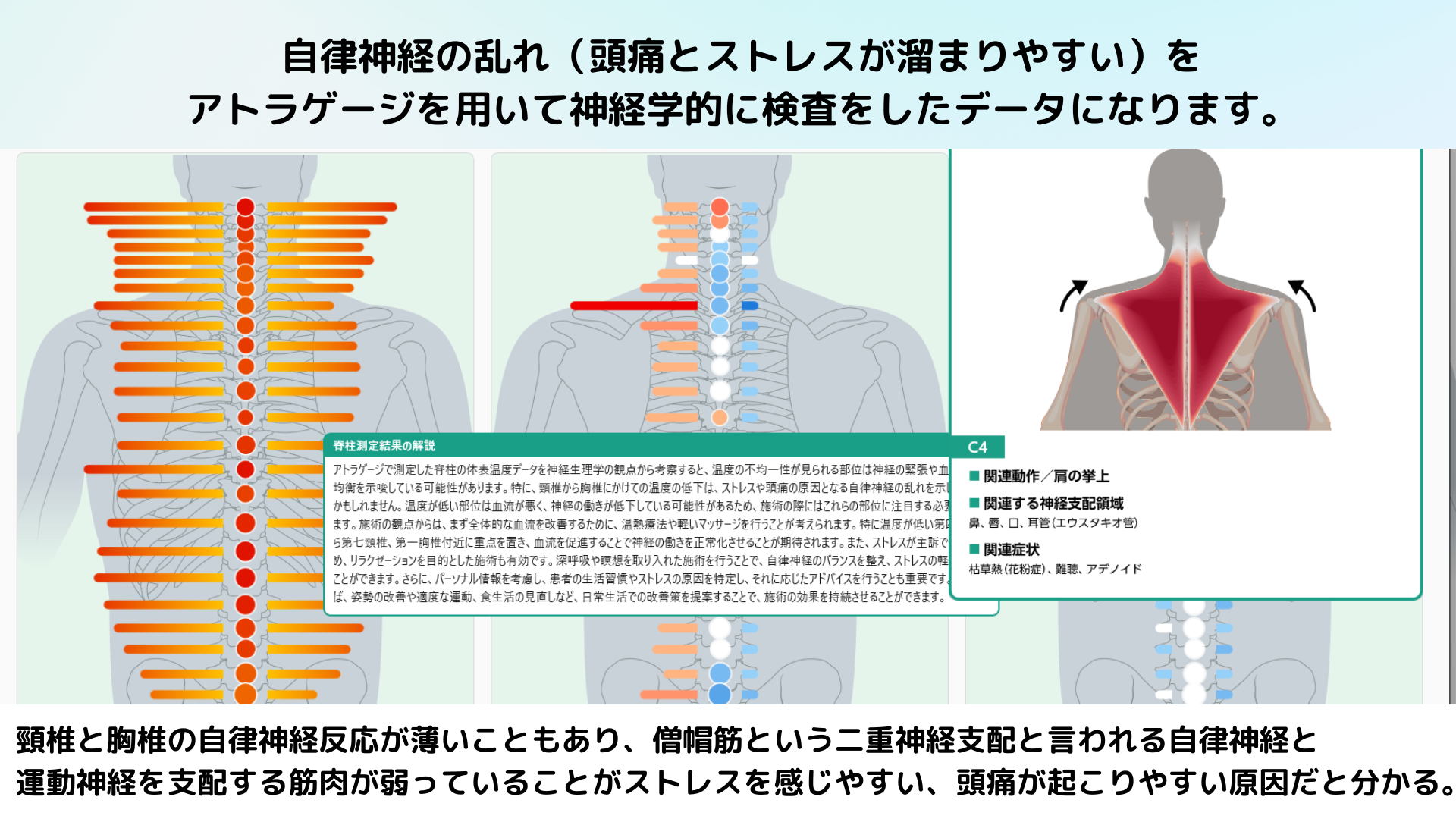 AI検査イメージ