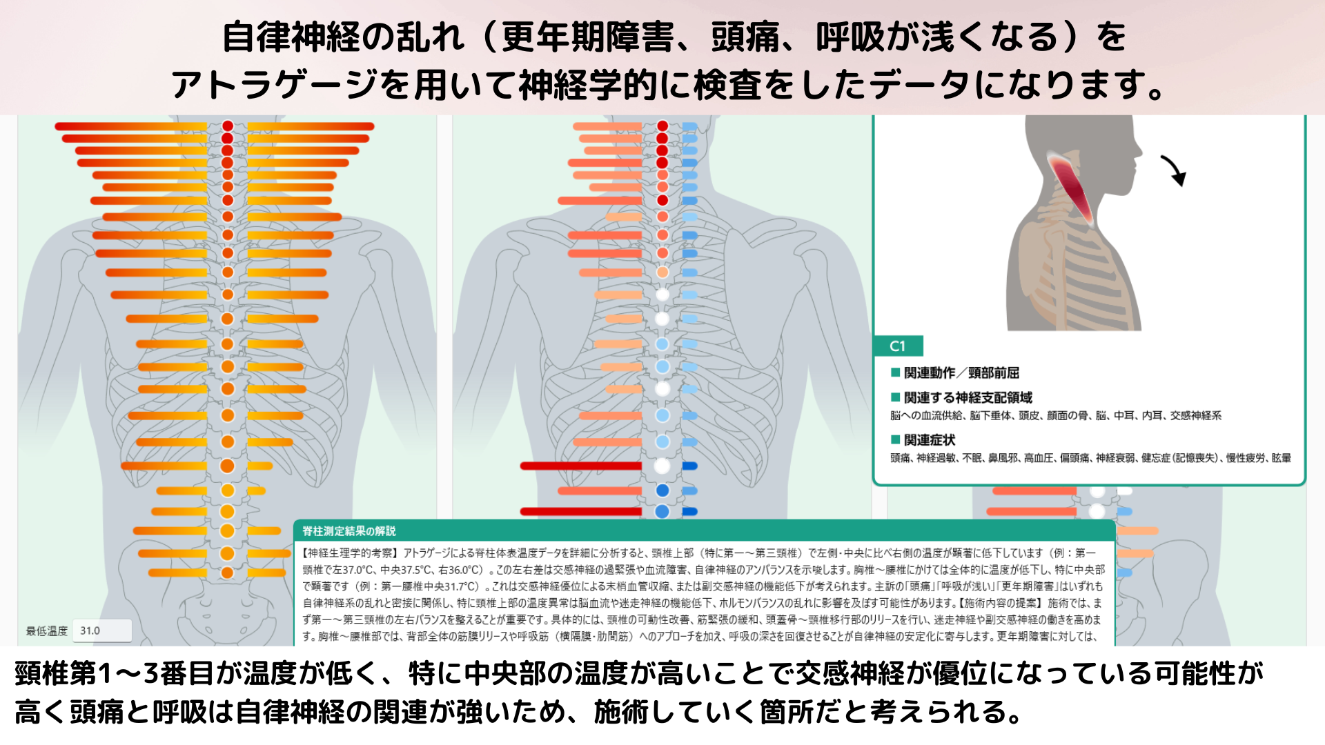 AI検査イメージ