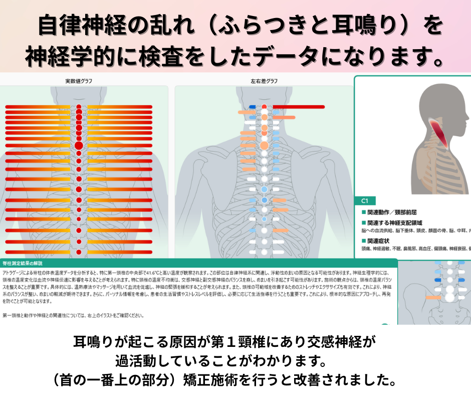AI検査イメージ